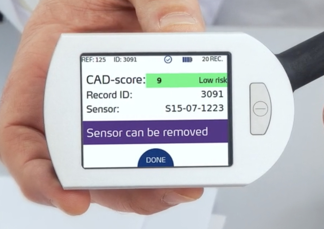 CADScor-FAQ CADScor device displaying low-risk CAD-score result for heart sound assessment in Oklahoma City